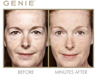 Instant Line Smoother Duo
