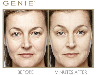 Instant Line Smoother Duo